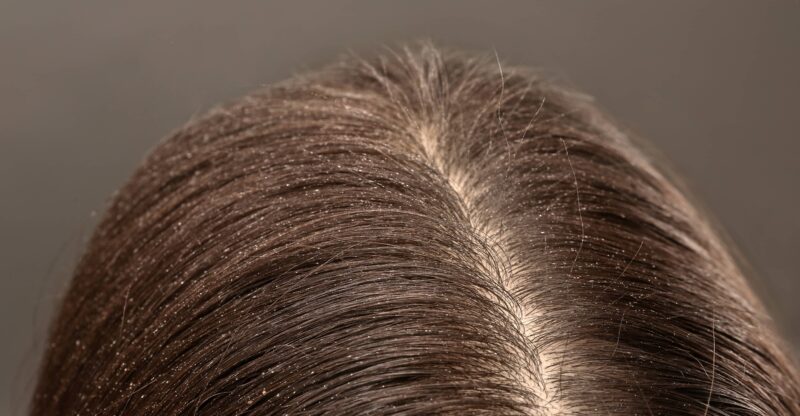 vichy dercos recenze